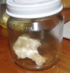 cauliflower