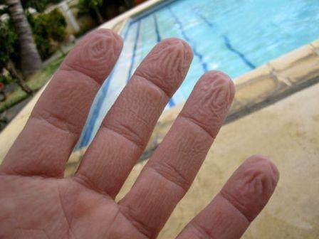 Wrinkled fingers